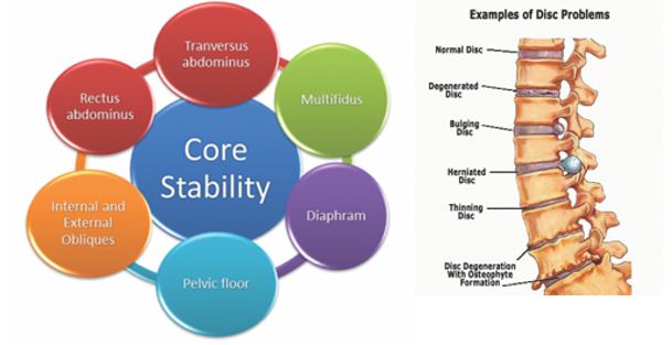 Managing Low Back Pain