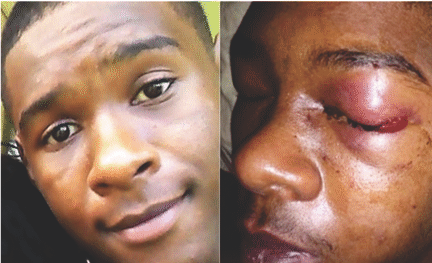 He loses an eye while police lose their way