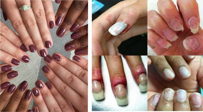 Pretty nails, not infection