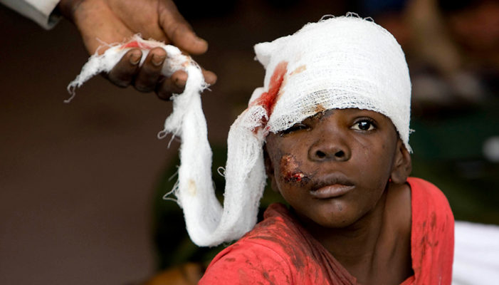 Injured in Haiti quake at high risk of infection, amputation