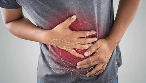 What You Need to Know About Crohn’s Disease