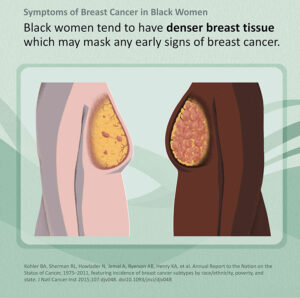 Breast tissue